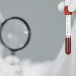 Anticoagulante